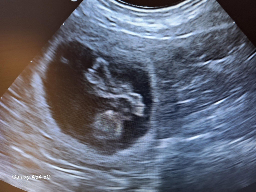 Pitchoune est gestante 